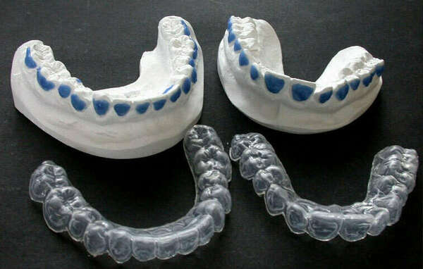 ALIGNEURS: LES DIFFERENTS TYPES DE TRAITEMENTS