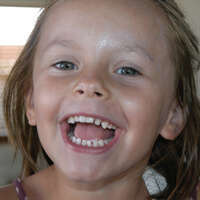 ORTHODONTIE PRECOCE