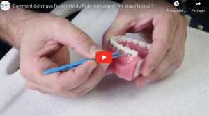 Comment éviter que l'extrémité du fil de mon appareil me pique la joue ?