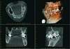 Radiographie 3D