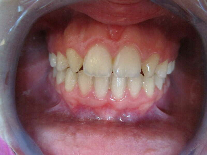 gzpdbvphdg_1658403548