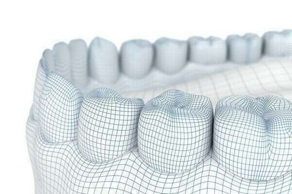 STRIPPING DENTAIRE (OU REMODELAGE DENTAIRE)