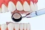 ENDODONTIE : TOUT SAVOIR