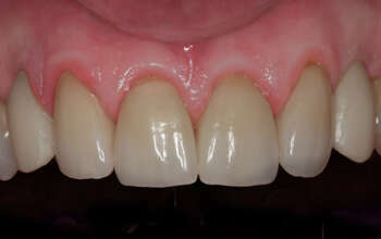 CAS TRAITES AU CABINET DENTAIRE DU DR DAAS