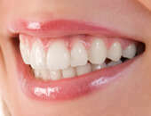 LE BLANCHIMENT DES DENTS « AU FAUTEUIL »