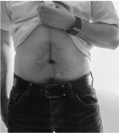 La Magnétiseur et la maladie de Crohn