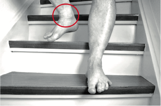 Le Magnétiseur, le Rebouteux et l’arthrose de la cheville