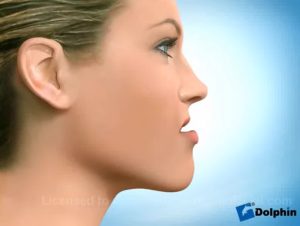 Traitement chirurgical des Classes 3