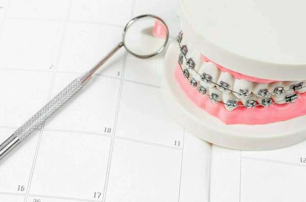 Conditions de réussite d'un traitement orthodontique