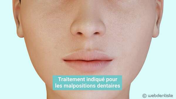 Traitement orthodontique - appareil multi-attache en céramique