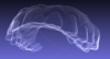 orthodontie simulations 3D