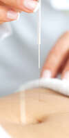 Valérie  Nadal, Acupuncture à Cluny