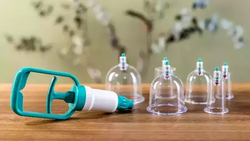 Hijama