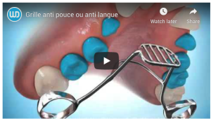 Grille anti pouce ou anti langue