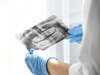 Implant dentaire et implantologie