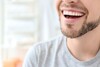 Sourire féminin montrant déminéralisation et protection de l'émail