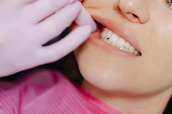Dents de sagesse : faut-il toujours les faire enlever ?