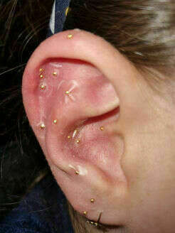 C'est nouveau, venez découvrir l'Auriculothérapie !