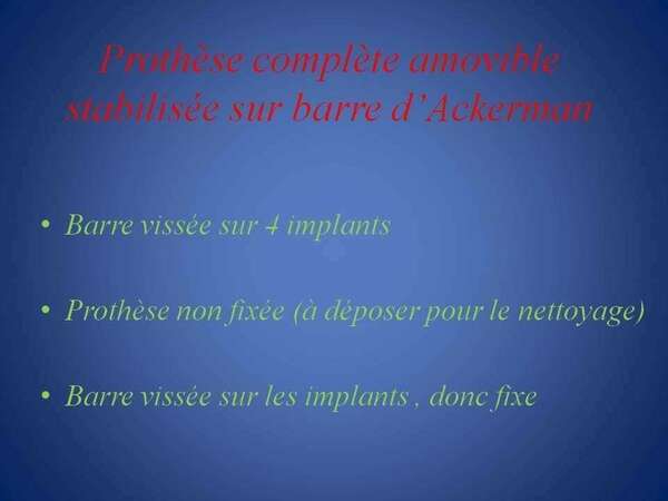 Prothèse complète amovible stabilisée sur barre d’Ackerman