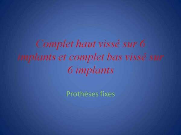 Complets haut et bas vissés sur 6 implants