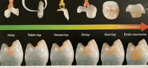 GRADIENT THÉRAPEUTHIQUE
