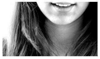 DENTISTERIE ESTHÉTIQUE : LES FACETTES DENTAIRES CÉRAMIQUES