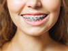 Traitements orthodontiques - Cabinet du Dr Josephine Toulemonde, Neuville en Ferrain (59960)
