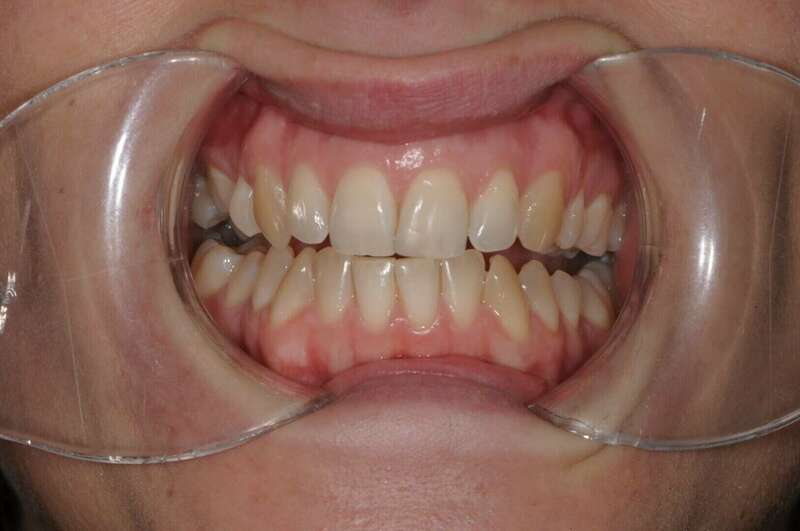 OILLIC AUDREY J0 (3)