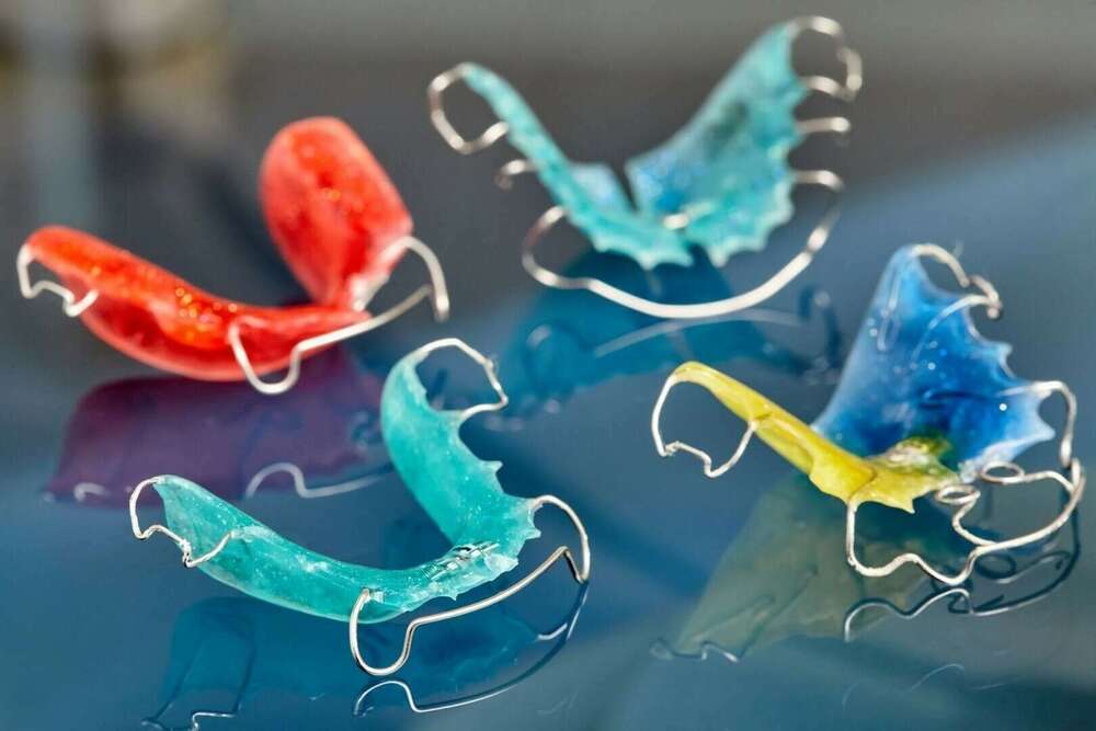 Bien entretenir son appareil orthodontique