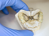disjoncteur, orthodontie interceptive, cabinet du dr robin collinot