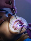 Traitement orthodontique par bagues au cabinet du Dr Collinot à Languidic