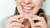 Orthodontie pour adultes, aligneurs transparents - Dr Collinot