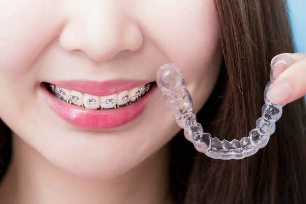 Contention de Hawley