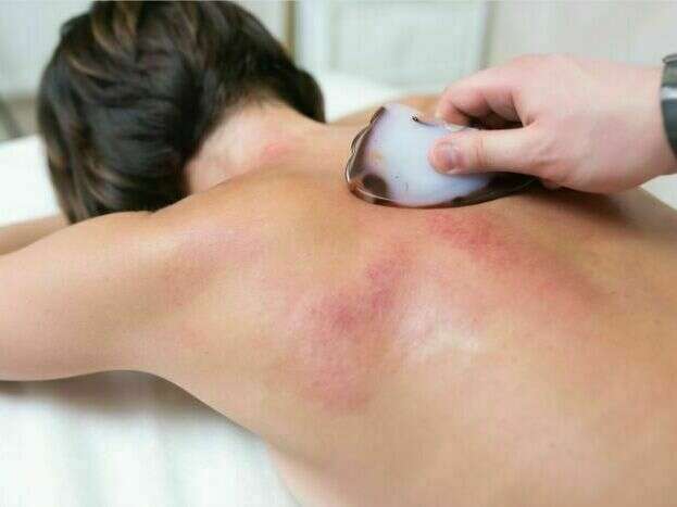 massage-du-dos-gua-sha-visage-rougeurs