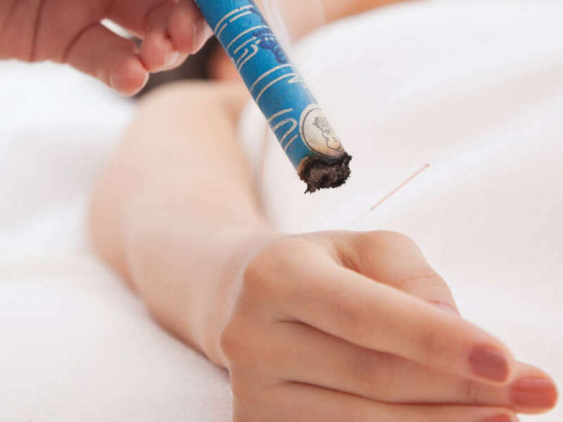 medecine-chinoise-traditionnelle-wilquin-soins-moxibustion