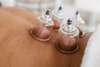 genève cupping