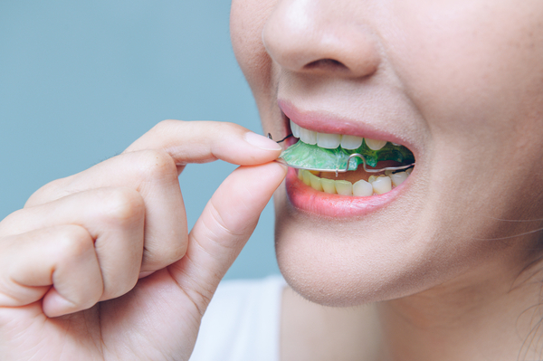 L'orthodontie fonctionnelle : indications et traitements