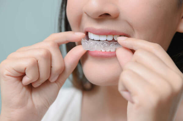 L'orthodontie invisible