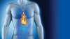 Reflux Gastro-Oesophagien