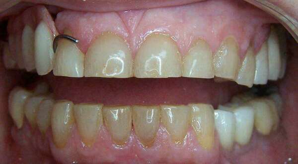 Cas de novembre 2021