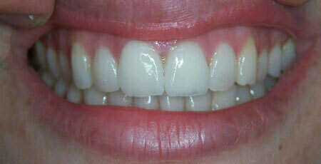 Cas de septembre 2020