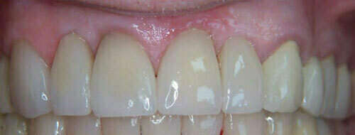 Cas de février 2019