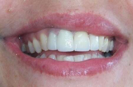 Cas du mois d'Avril 2019