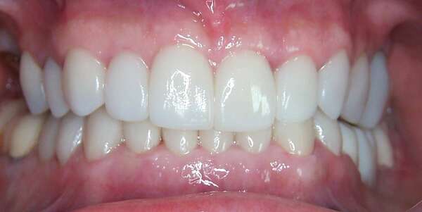 Restructuration du sourire - Cas du mois d'octobre 2015