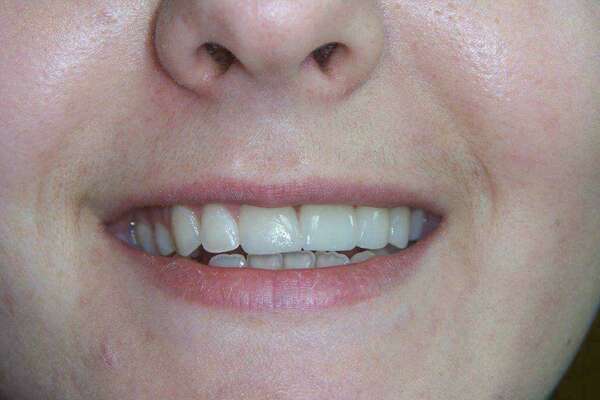 Comment traiteriez-vous ce cas ? La réponse !