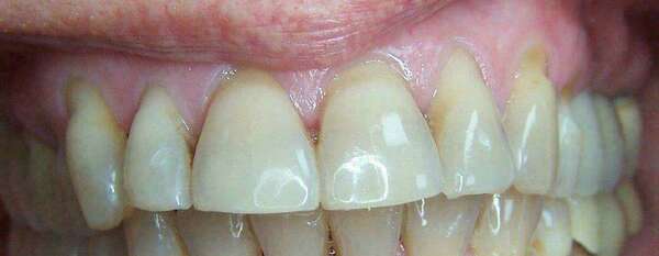 Cas de septembre 2019