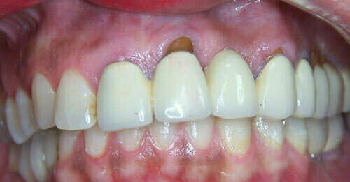 Cas de novembre 2019