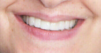 Cas du mois de Février 2018