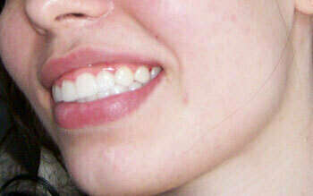 Cas du mois de Juillet 2017