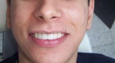 Cas du mois d’Août 2018